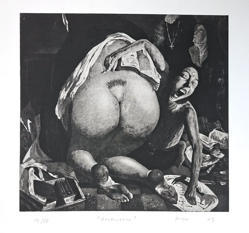 Zhao Yongbo (*1964): Akupunktur - (Radierung / 2007, signiert, betitelt, Blatt 12 von 88)
